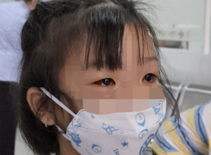 Mỗi tuần khám 700- 800 ca đau mắt đỏ: Người đã mắc bệnh có thể bị lại không?