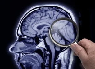 Mỹ không tìm thấy bằng chứng tổn thương não do “Hội chứng Havana”